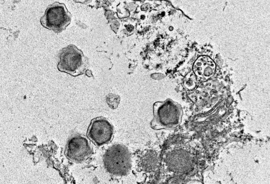 US researchers identify 230 new viruses with surprising effect on ocean health