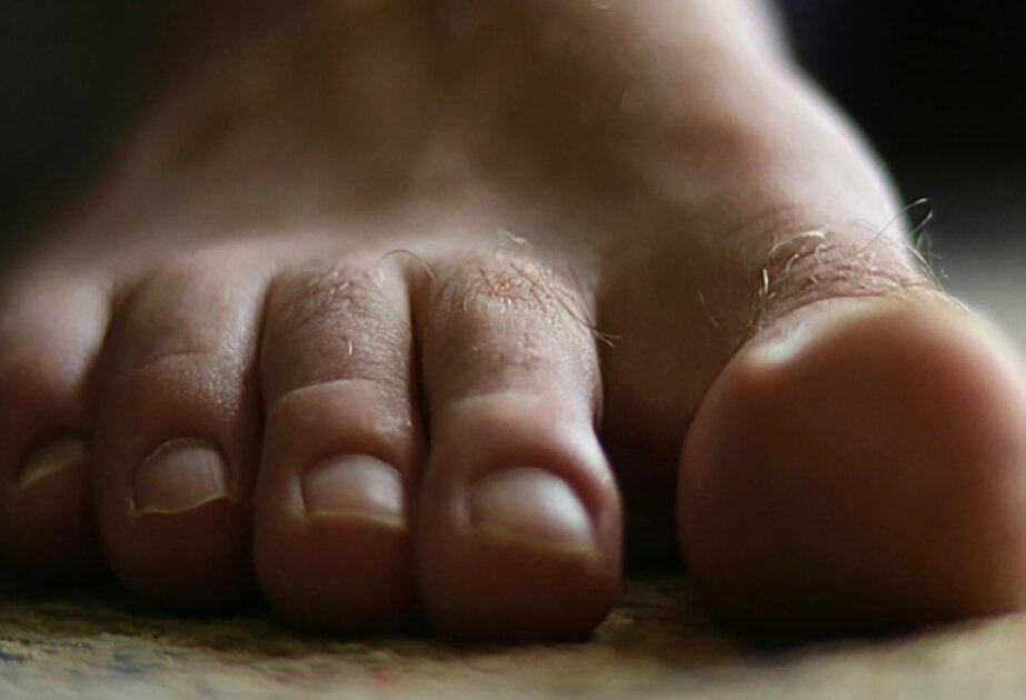 What lives between your toes? A microbiologist explains