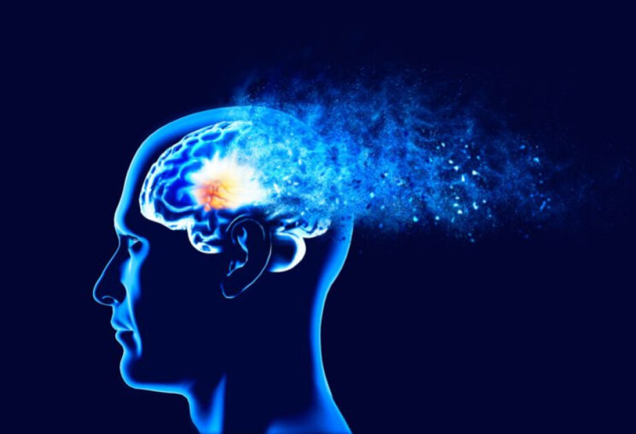 Brain shape changes could offer early warning signs of dementia